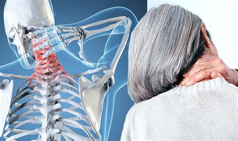 neck pain rheumatoid arthritis